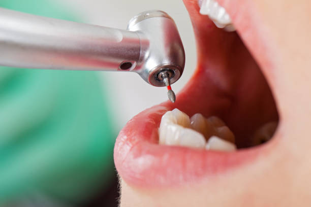 Best Urgent Care for Lost Fillings or Crowns in Norton Shores, MI
